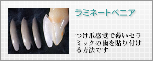 ラミネートベニア つけ爪感覚で薄いセラミックの歯を貼り付けるほうほうです